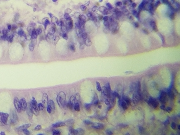 Simple Columnar Epithelium Slides - Simple Columnar Epithelium 11 400X